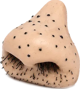 Nochal